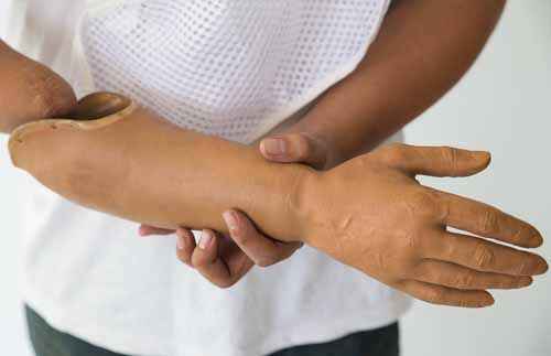 general limb care