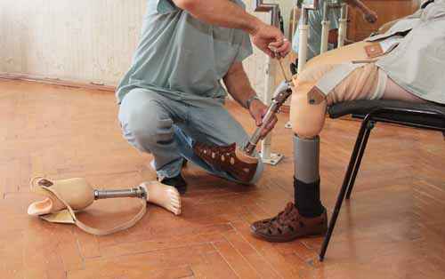prosthetic safety check